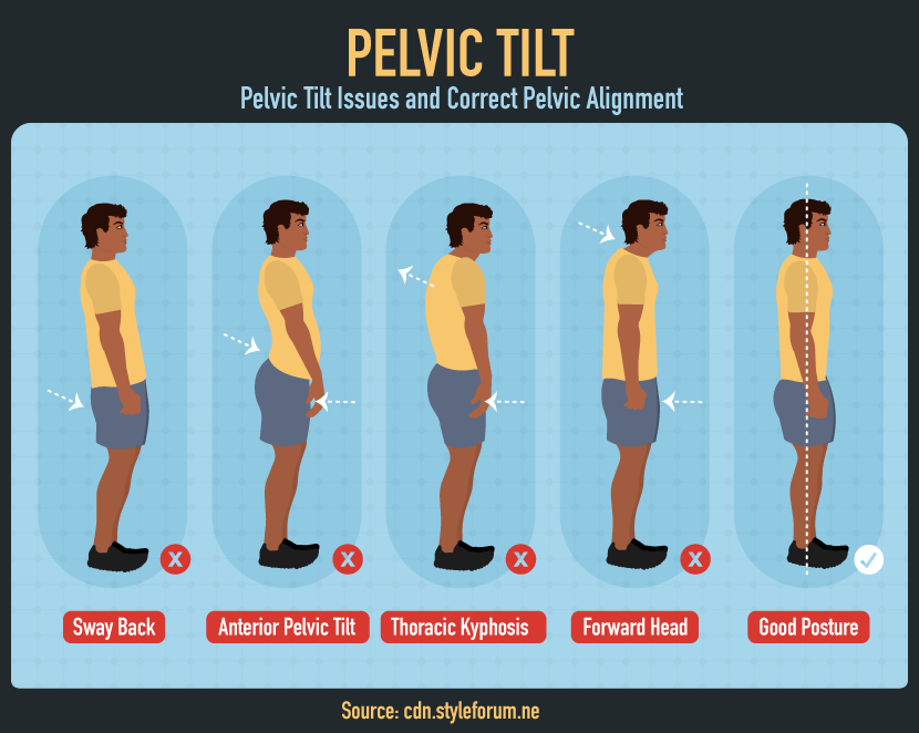 Improve Your Posture From Head to Toe