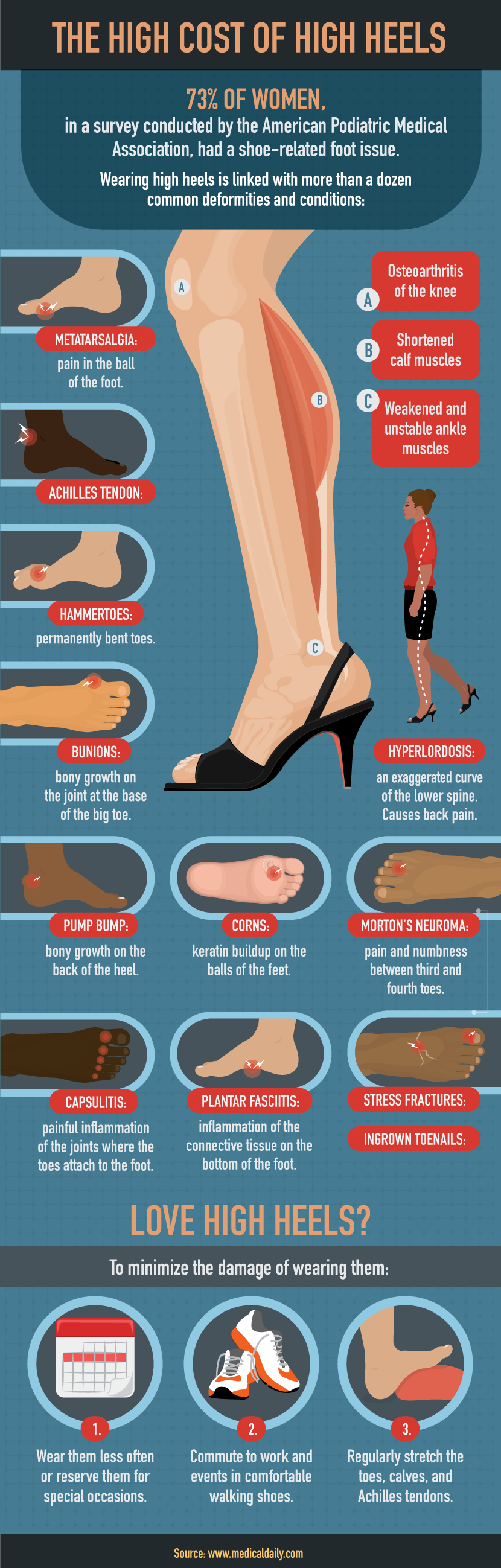 What causes foot pain and how to deal with it